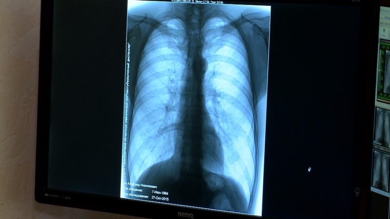 Раннее выявление туберкулеза – залог успешного лечения